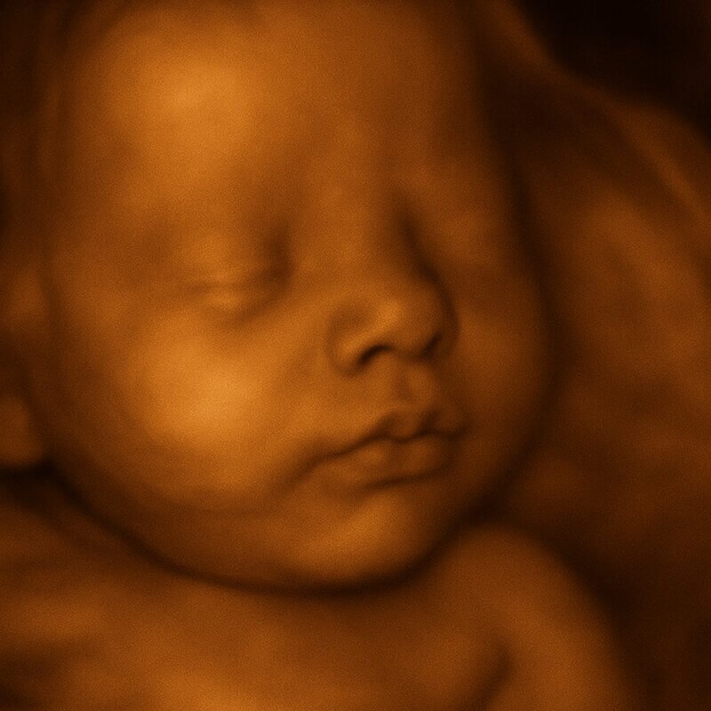 Image of a baby in 3D ultrasound